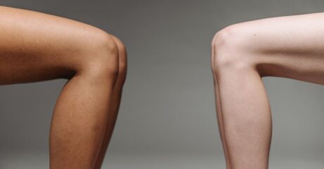 Kurz jak na&nbsp;bolesti těla koleno